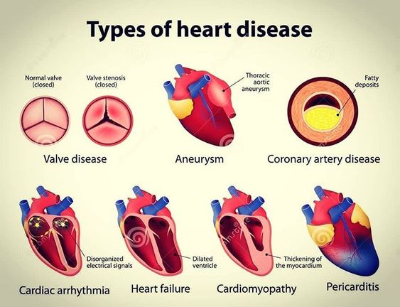 Heart disease types at healthmonastery