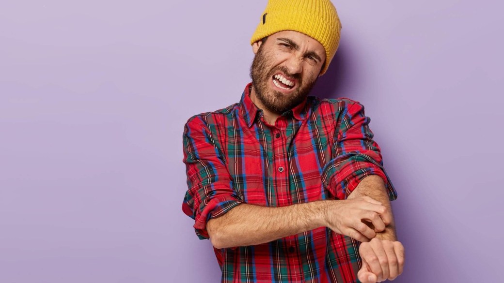 A boy suffering with psoriasis