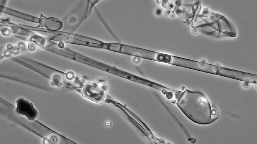 black fungus under microscope