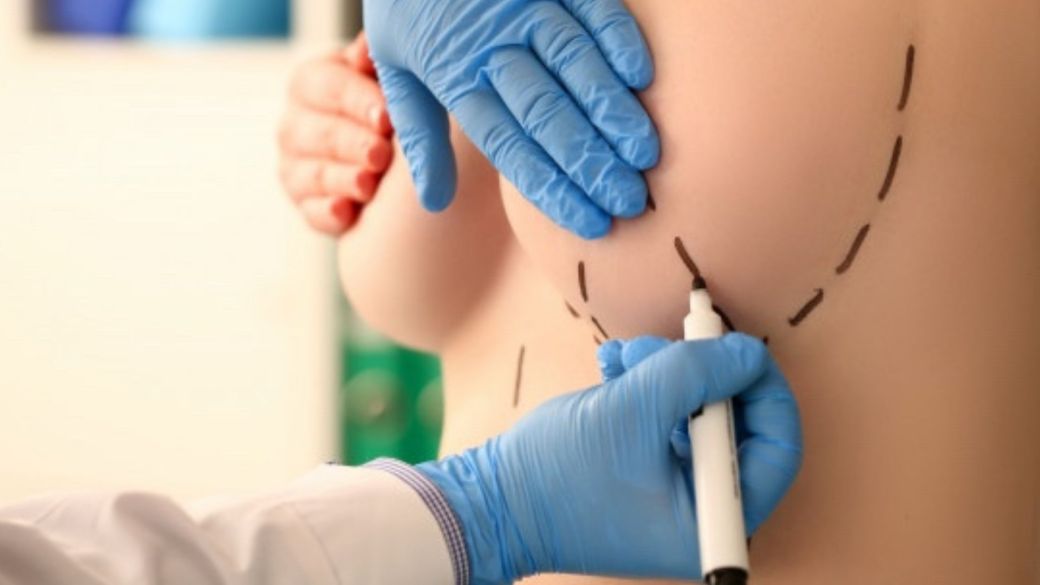 Breast implant surgery healthmonastery